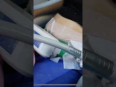 Heb je het bevriezen van vet geprobeerd om af te vallen?