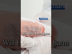 Zal HIFU pijn doen?