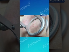 HIFU versus CO2 laser, welke anti-aging behandeling heb je liever?