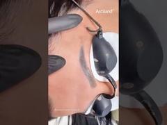 Nd Yag Laser voor het verwijderen van wenkbrauwtatoeages #ndyaglaser #tattooremovallaser #beautymachine #laserclinic