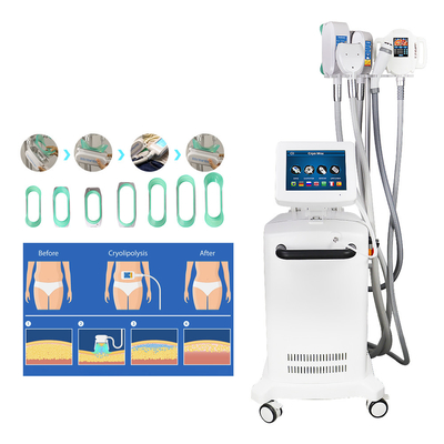 Koel het Vermageringsdieetmachine van Beeldhouwwerkcryolipolysis voor Vette Vermindering