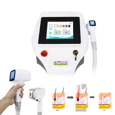 Permanente Haarverwijdering Nova Ice Diode Laser Machine 3 Golf 808nm
