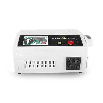 Van het Pigmentq Geschakelde Nd Yag van ISO 532nm de Lasermachine